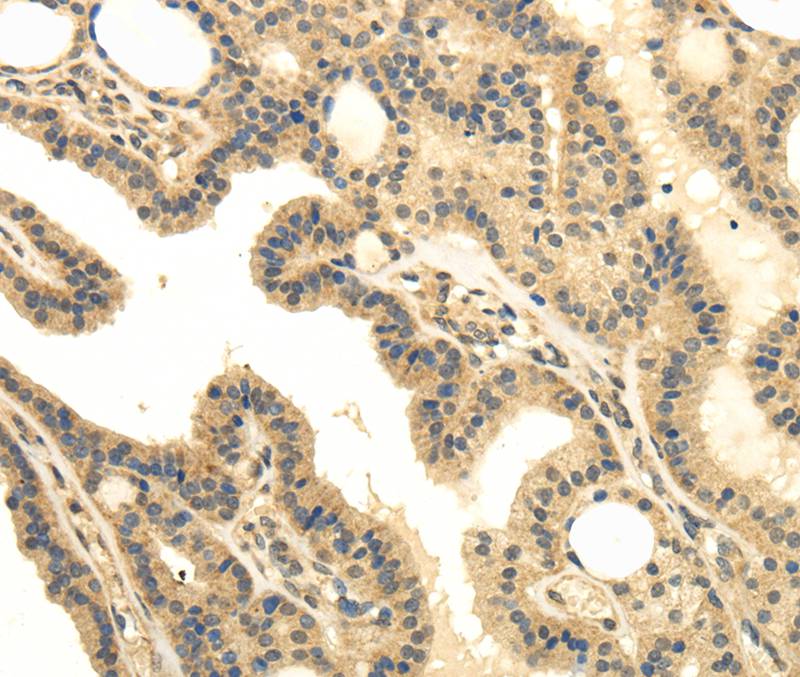 MED16 Antibody