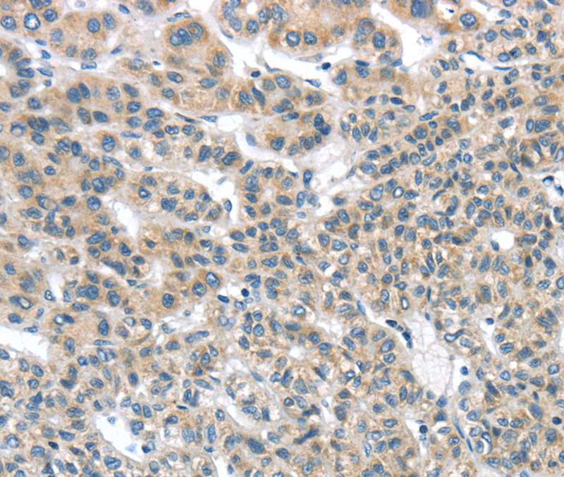 THSD1 Antibody