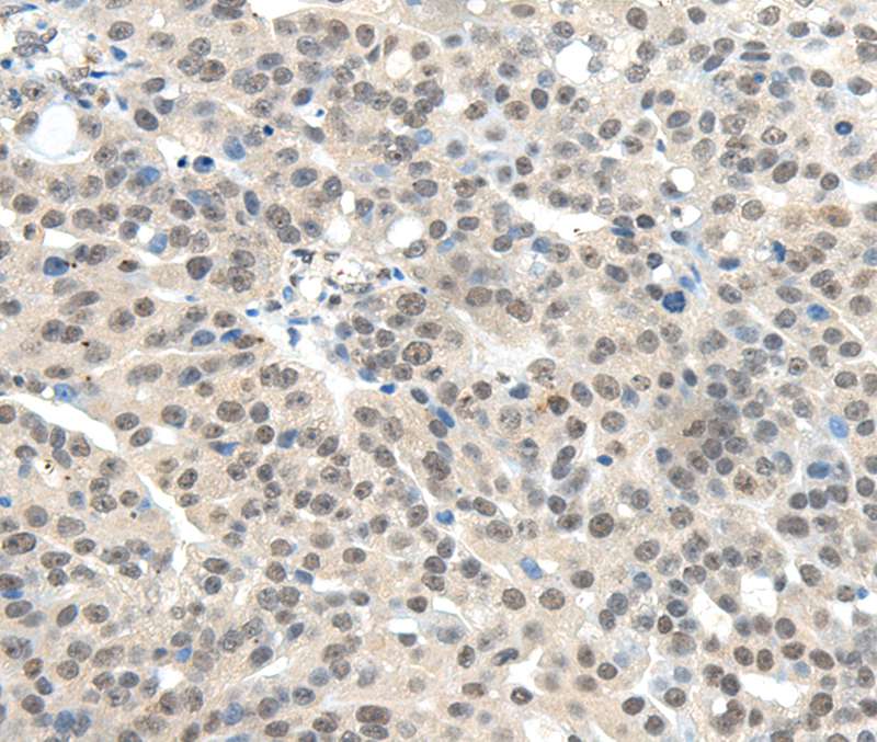 TRIM11 Antibody