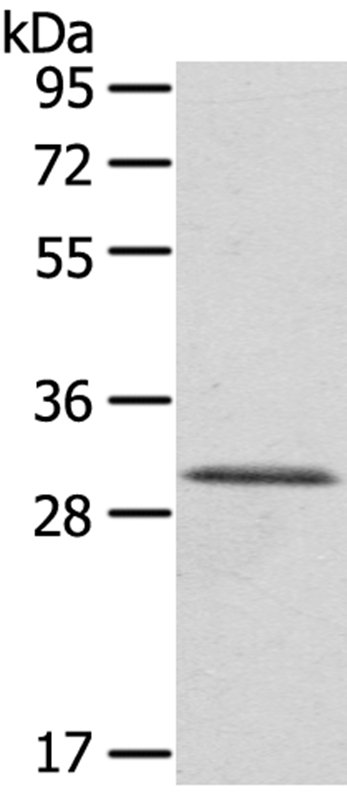 HTATIP2 Antibody