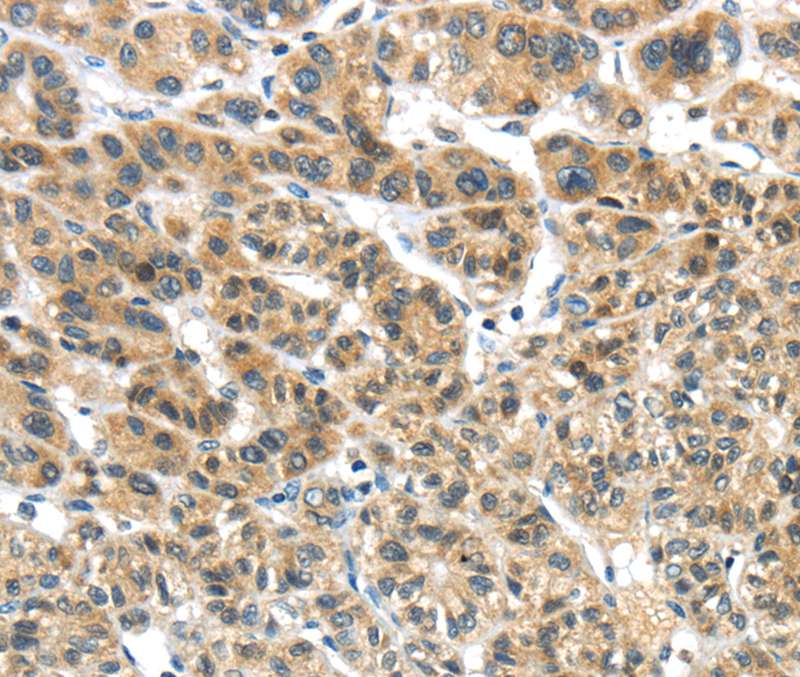 TKTL1 Antibody