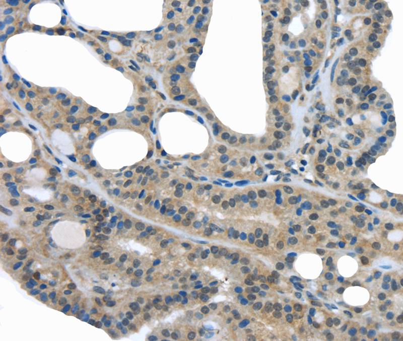 UCHL3 Antibody