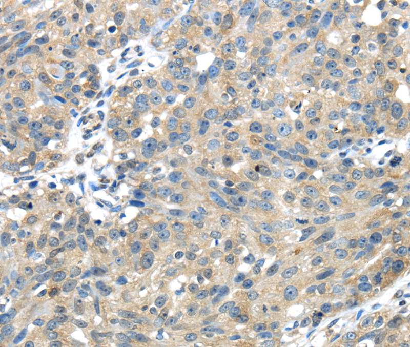 UGP2 Antibody