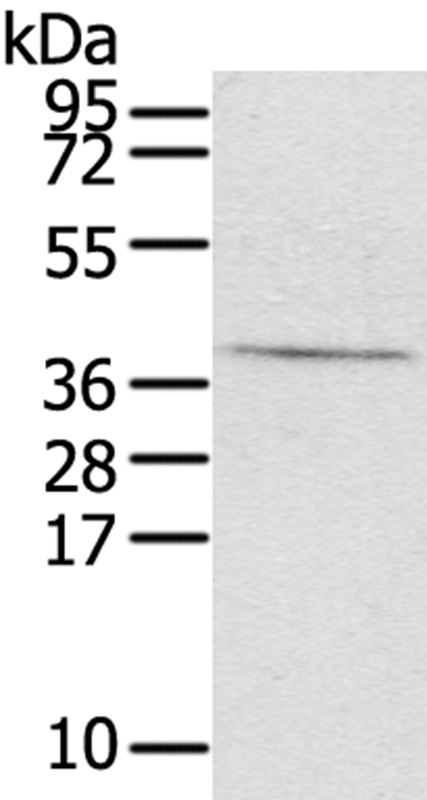 EFNB3 Antibody