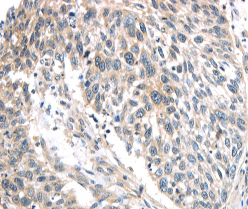 IQGAP2 Antibody