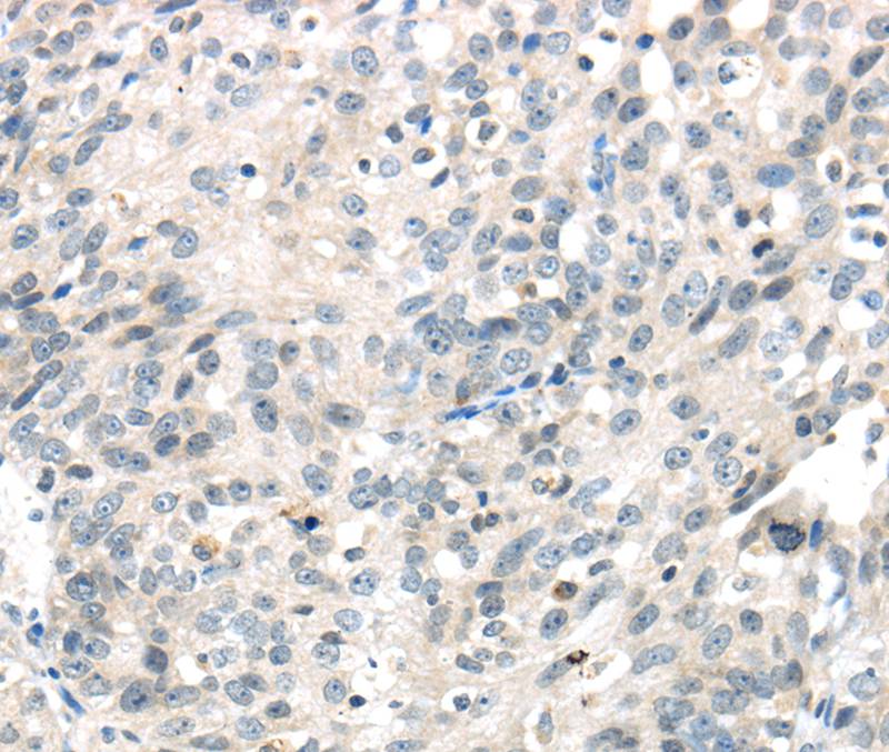 IQGAP2 Antibody