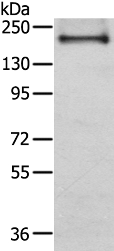 IQGAP2 Antibody