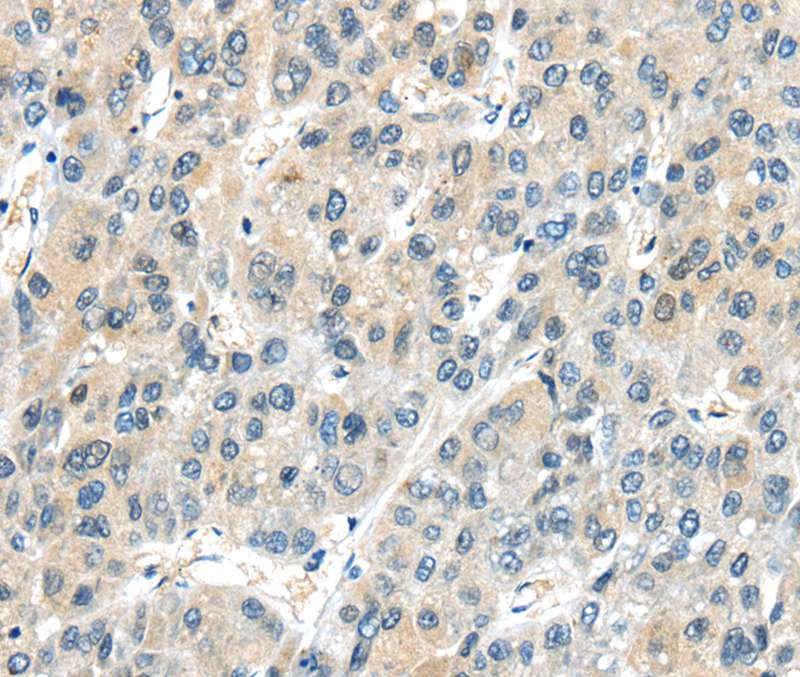 AHI1 Antibody - SAB | Signalway Antibody