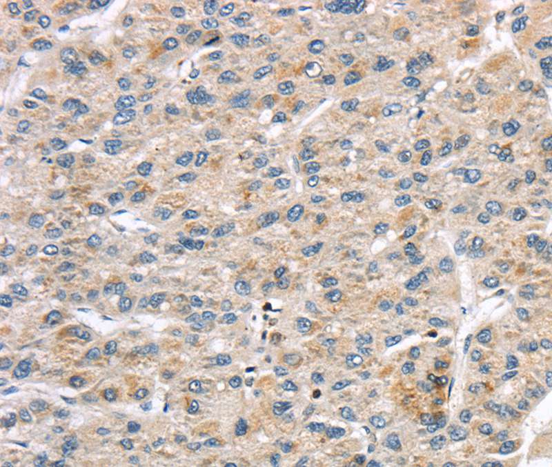 LZTS1 Antibody