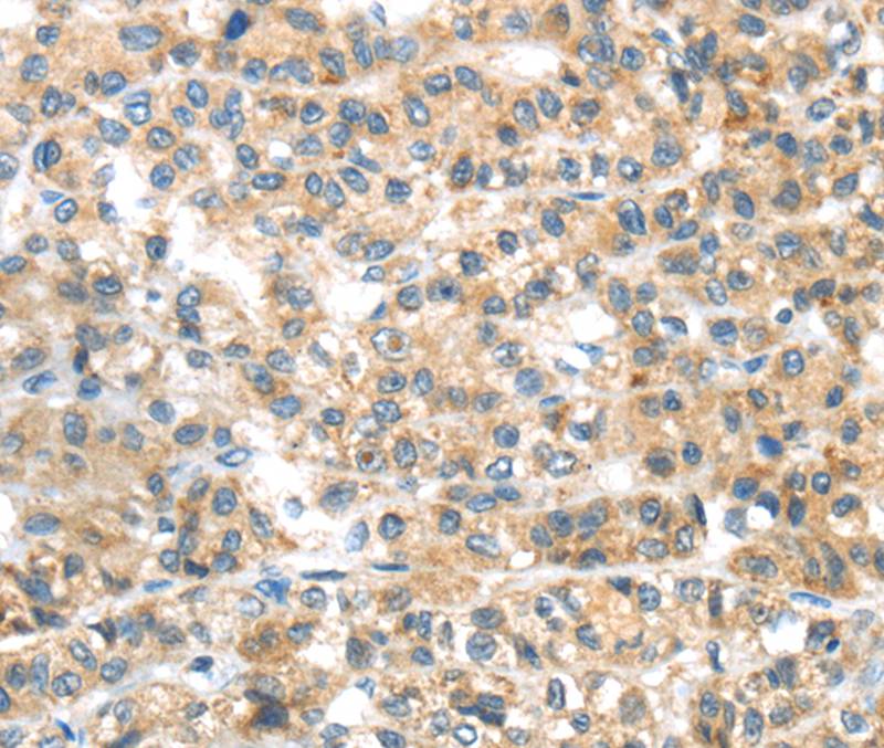 PLAGL2 Antibody