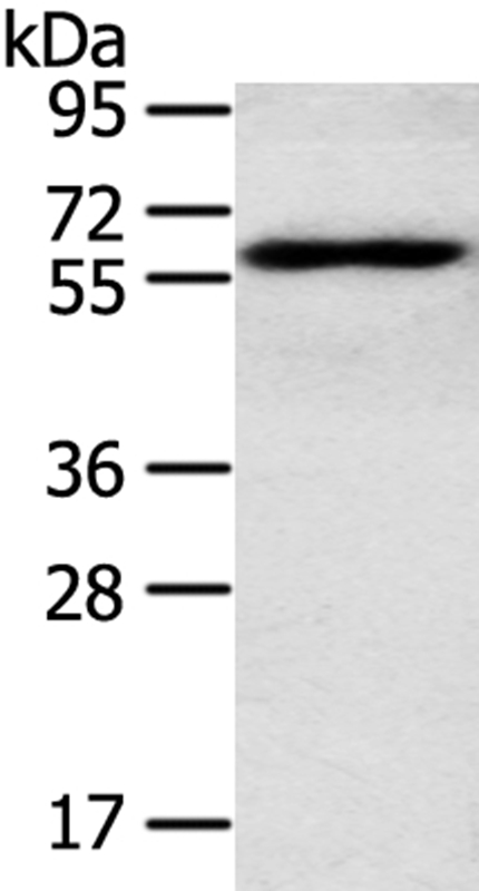 RORA Antibody