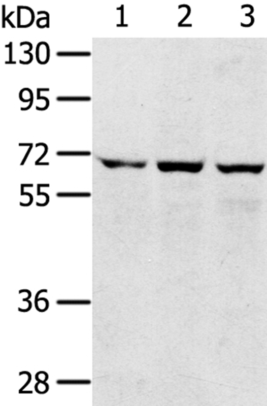 SLC5A9 Antibody