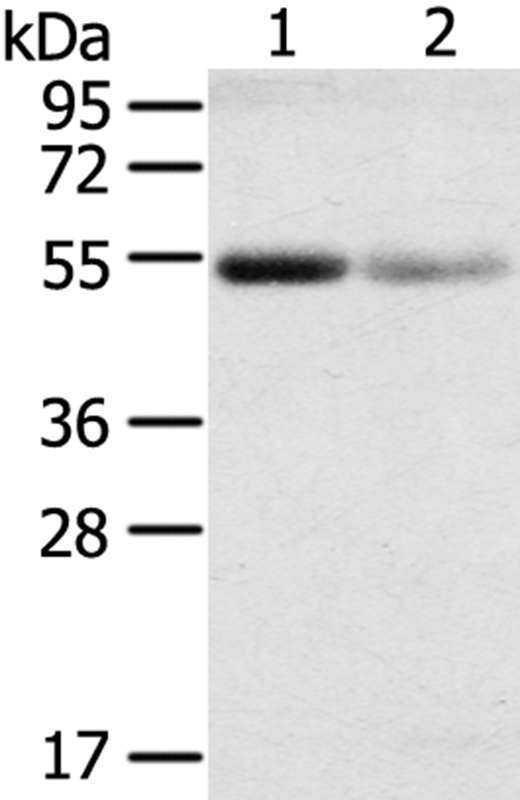 SLC17A1 Antibody