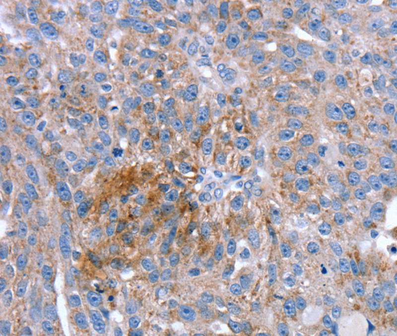 SPATA5L1 Antibody