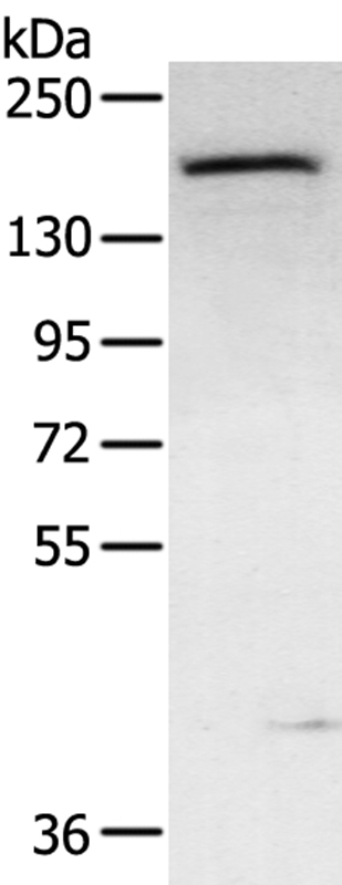 ABCC9 Antibody