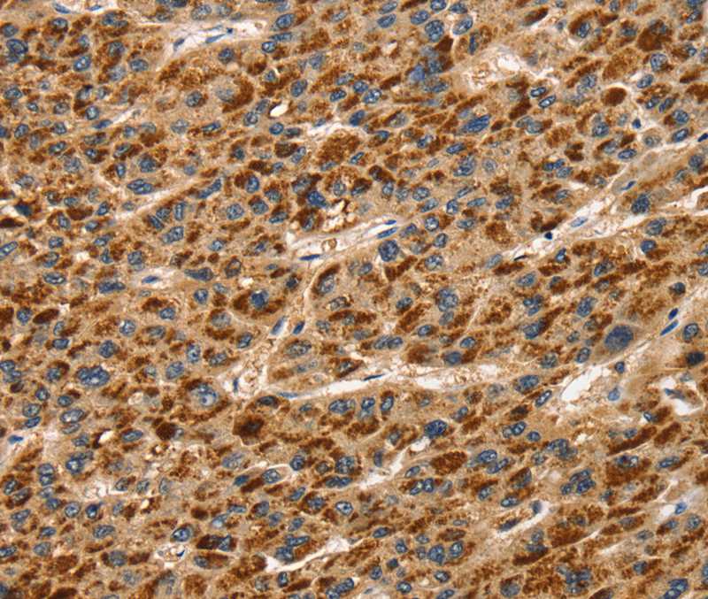 TLN1 Antibody