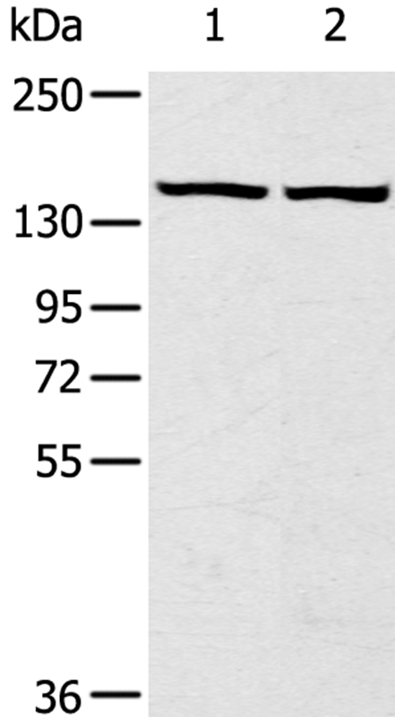 TBC1D4 Antibody