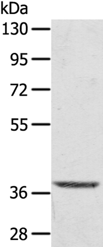 TBC1D21 Antibody