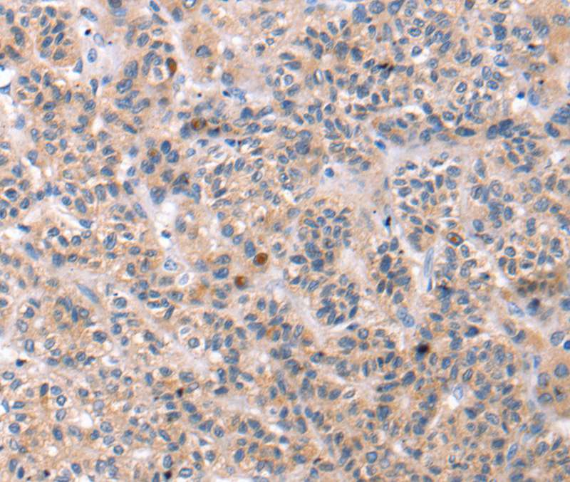 TCERG1L Antibody