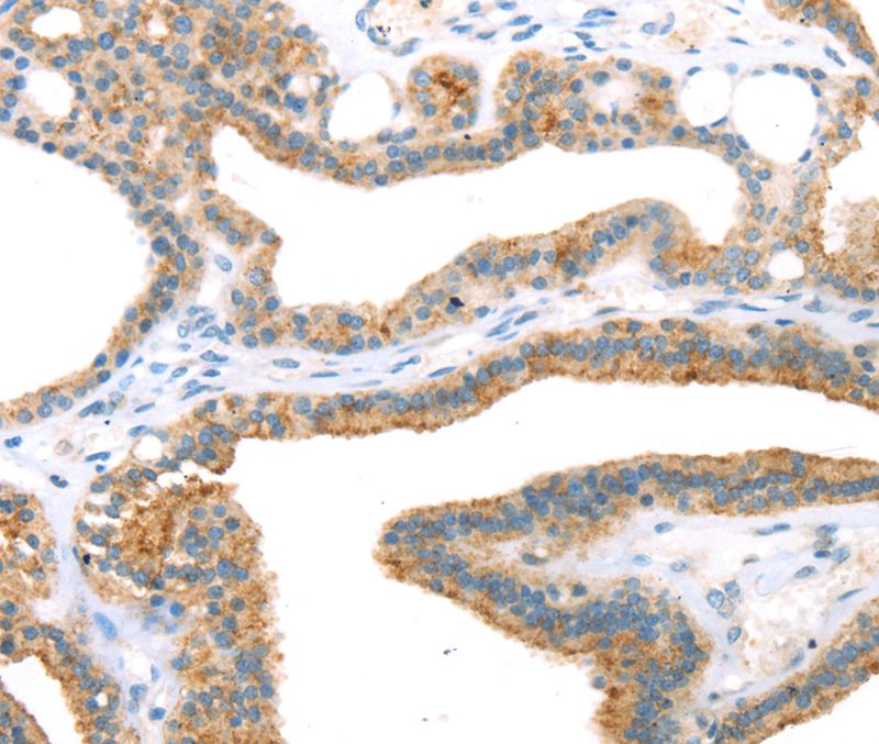 TNIP2 Antibody