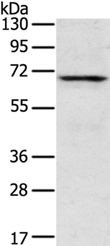 TNK1 Antibody