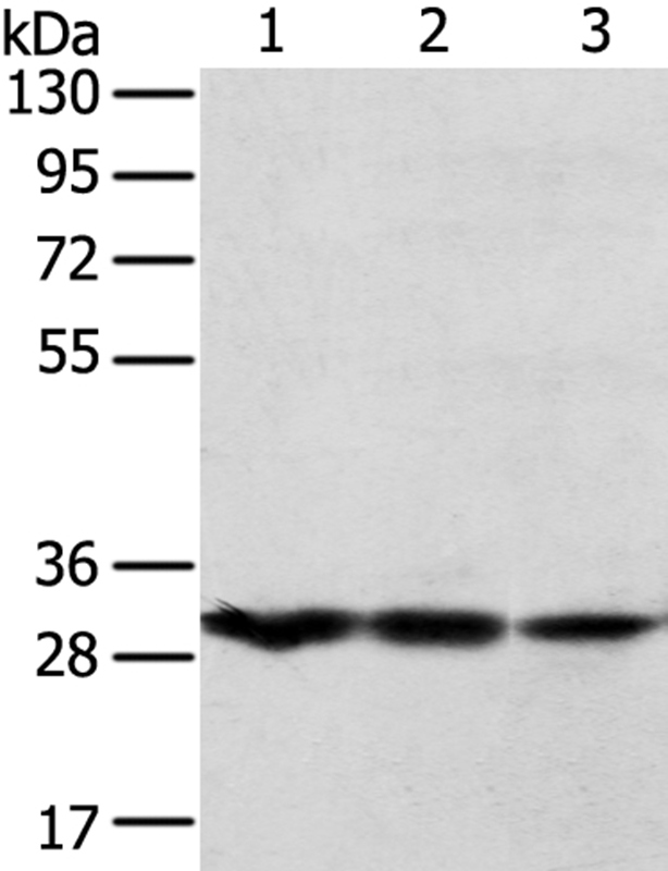 TPD52L2 Antibody