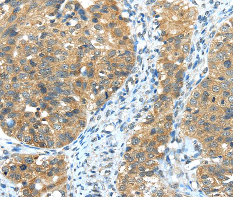 TRIB1 Antibody