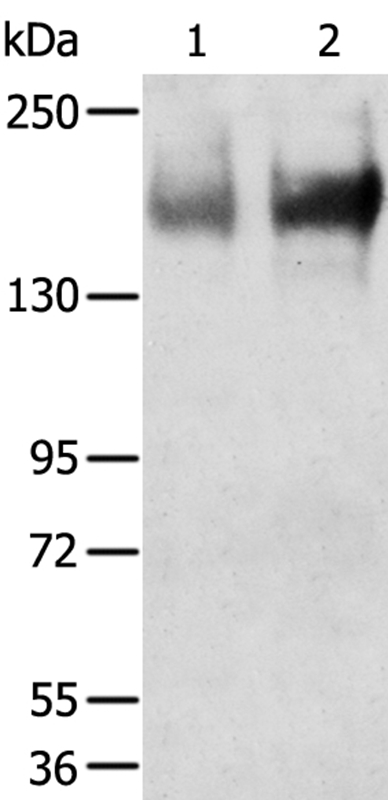 TRPM6 Antibody