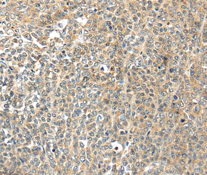 TSPYL6 Antibody