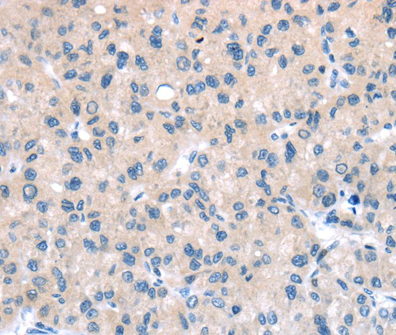 TTI1 Antibody