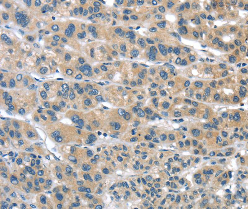 TUSC1 Antibody