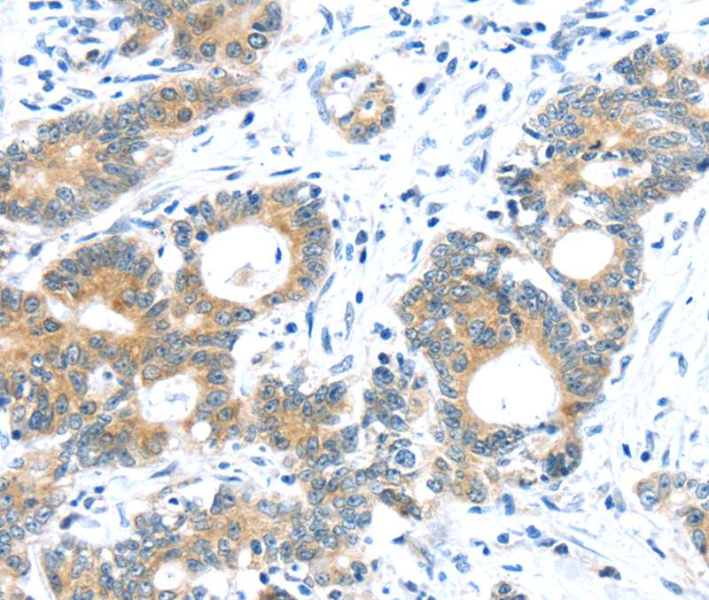 TUSC1 Antibody