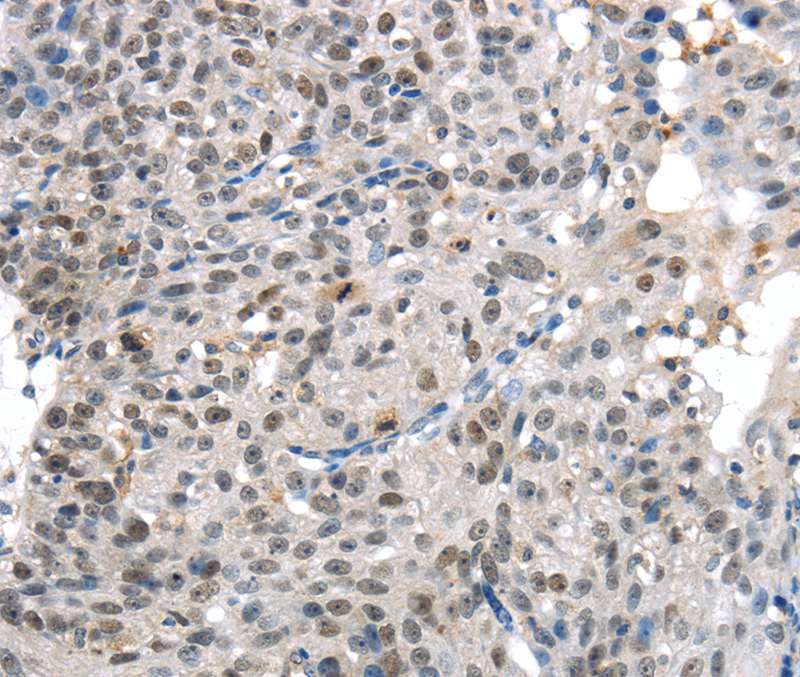 KDM5C Antibody