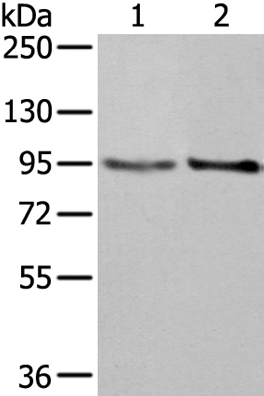 NUP98 Antibody