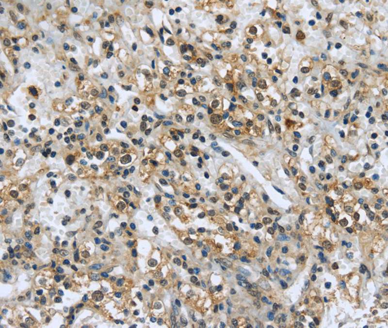 USP28 Antibody