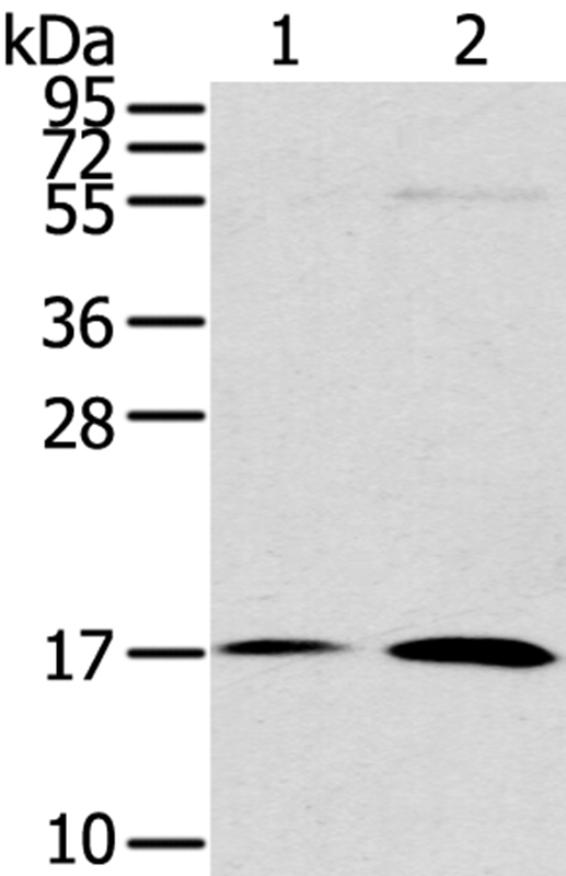 UTS2B Antibody