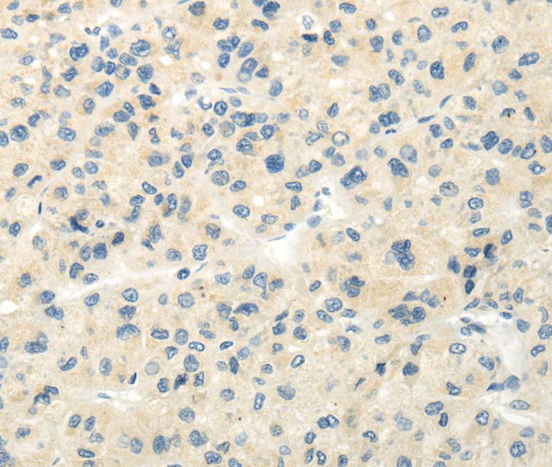 VIPR1 Antibody