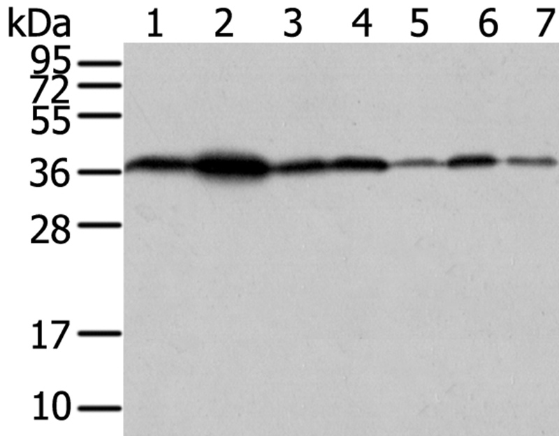 VPS26A Antibody