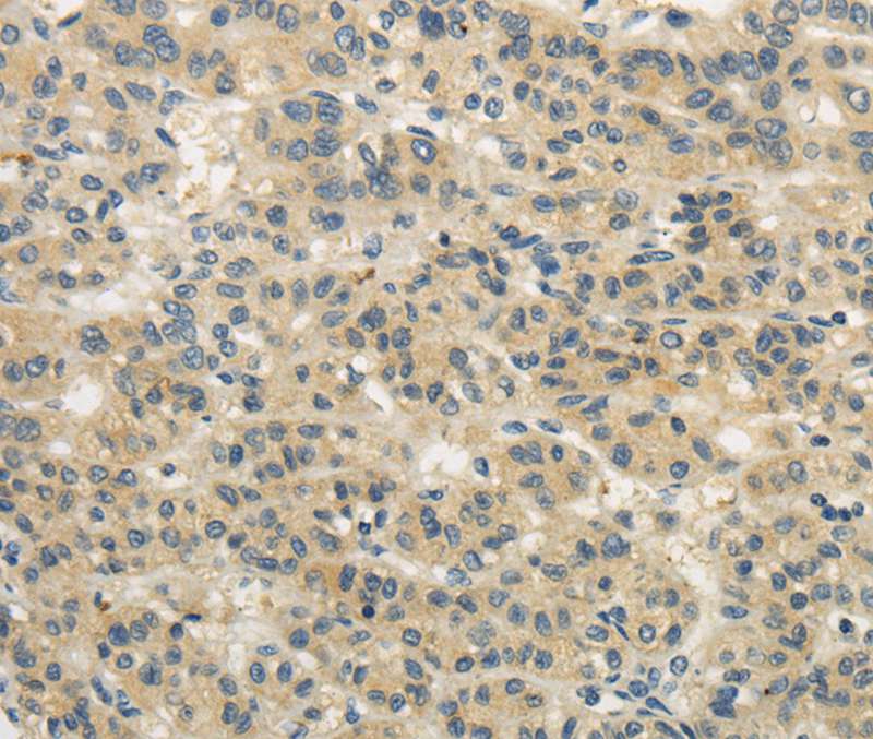 WDR91 Antibody