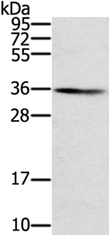 SNX11 Antibody