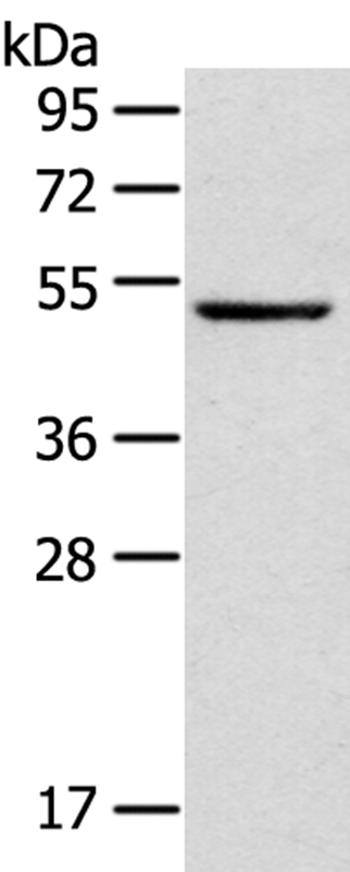 TRIM49 Antibody