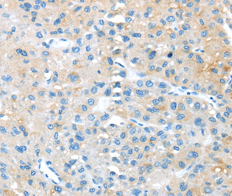 TNFSF4 Antibody