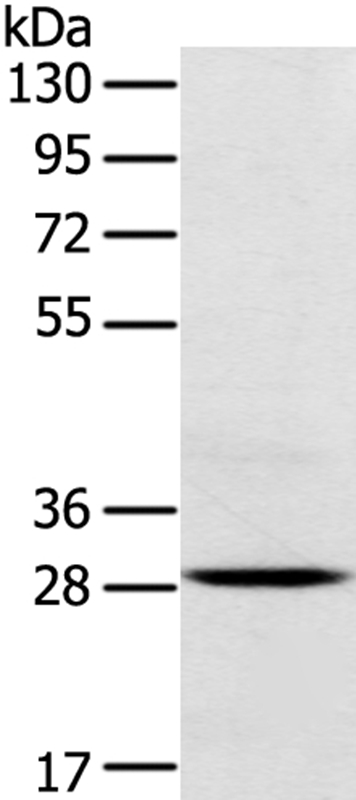 TREM2 Antibody