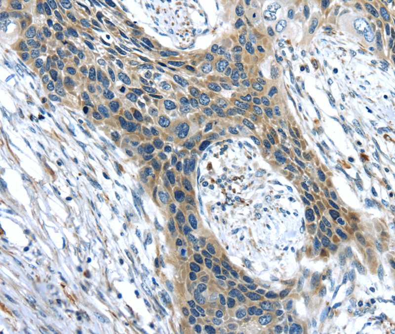 CHRDL1 Antibody