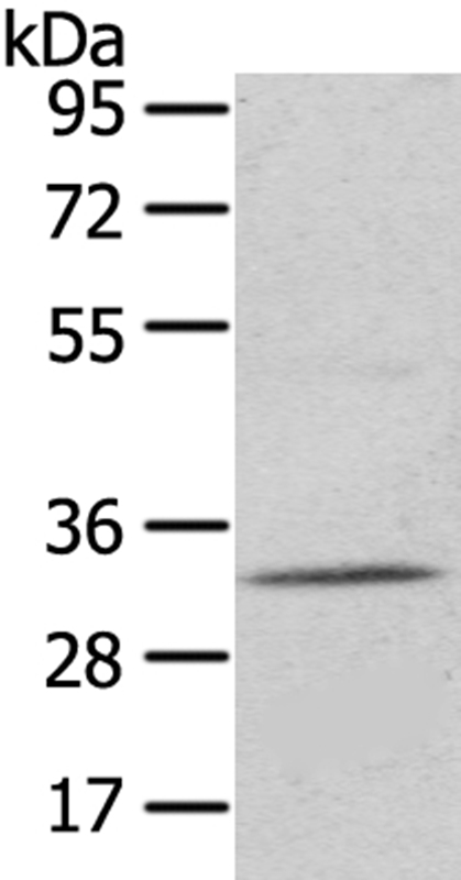 UPP2 Antibody