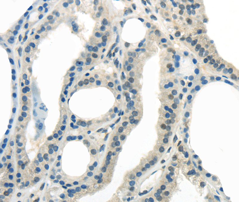 ENTPD1 Antibody