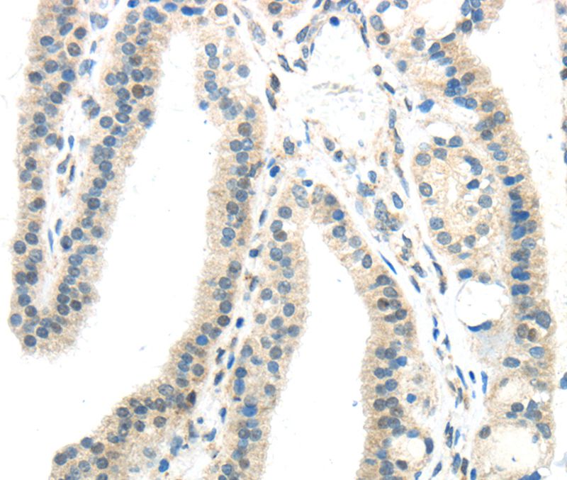 IL12A Antibody