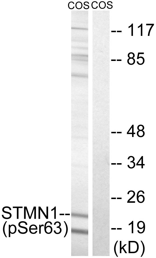 STMN1 (Phospho-Ser63) Antibody