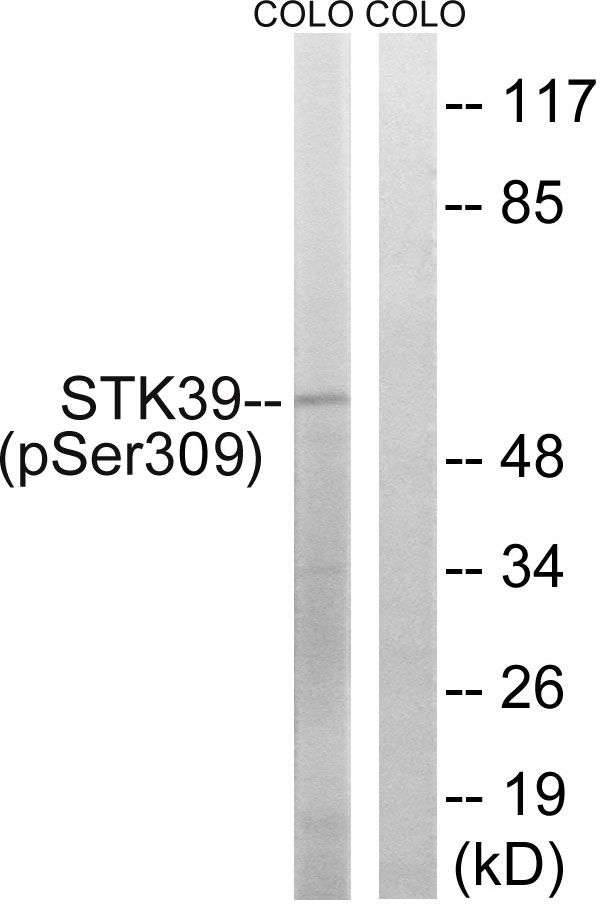 STK39 (Phospho-Ser309) Antibody