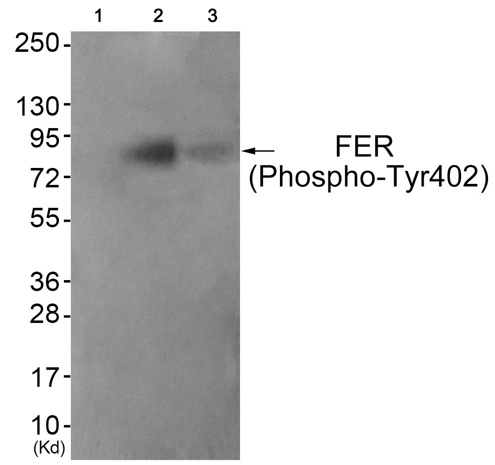 FER (Phospho-Tyr402) Antibody